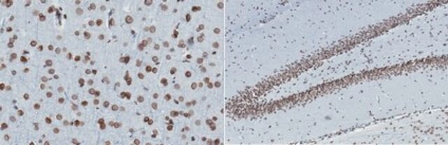 Anti-Lamin A and C Antibody, clone 2F4.1 clone 2F4.1, from mouse