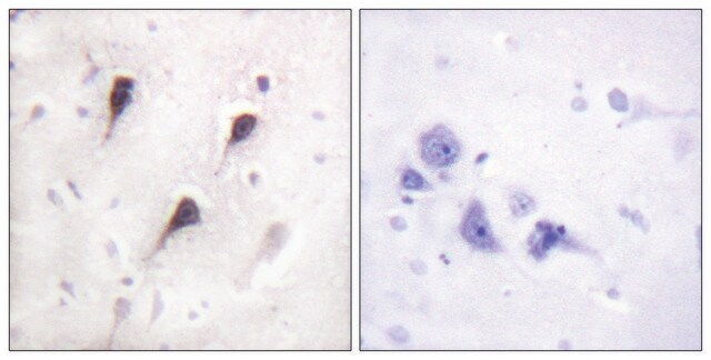 Anti-WAVE1 antibody produced in rabbit affinity isolated antibody