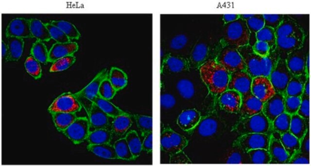 Anti-p32 Antibody from rabbit, purified by affinity chromatography