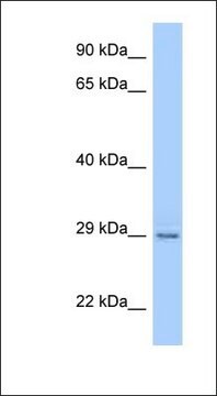 Anti-PAQR4 antibody produced in rabbit affinity isolated antibody