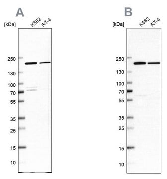 Anti-EPRS antibody produced in rabbit Prestige Antibodies&#174; Powered by Atlas Antibodies, affinity isolated antibody, buffered aqueous glycerol solution