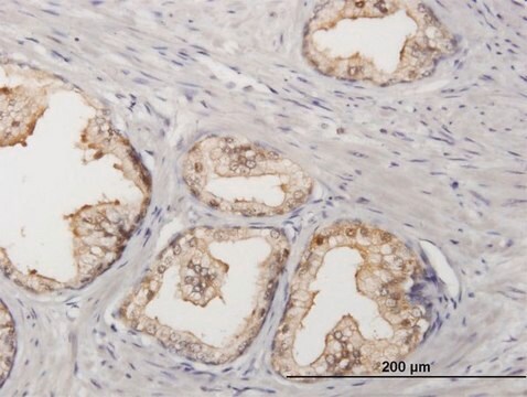 Anti-SORD antibody produced in mouse purified immunoglobulin, buffered aqueous solution