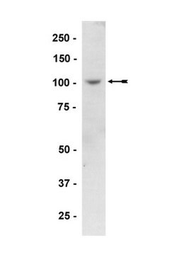 Anti-PKD2-Antikörper Upstate&#174;, from rabbit