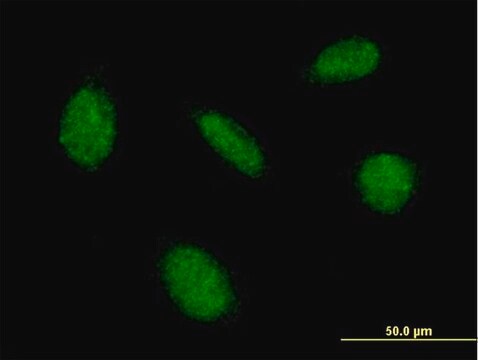 Anti-CAMK4 antibody produced in mouse purified immunoglobulin, buffered aqueous solution