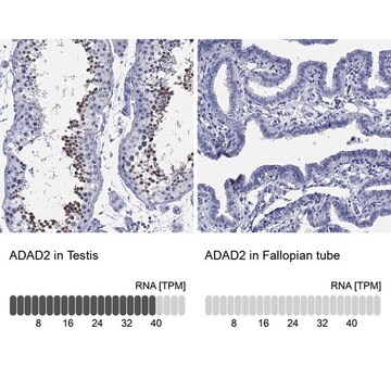 Anti-ADAD2 antibody produced in rabbit Prestige Antibodies&#174; Powered by Atlas Antibodies, affinity isolated antibody, buffered aqueous glycerol solution