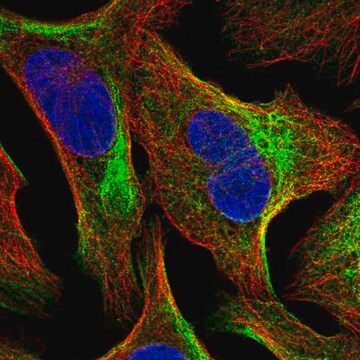 Anti-TMEM81 antibody produced in rabbit Prestige Antibodies&#174; Powered by Atlas Antibodies, affinity isolated antibody