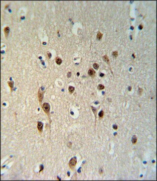 ANTI-TOX3 (CENTER) antibody produced in rabbit IgG fraction of antiserum, buffered aqueous solution