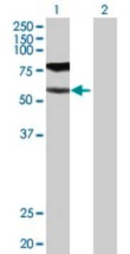 Anti-GGT1 antibody produced in rabbit purified immunoglobulin, buffered aqueous solution