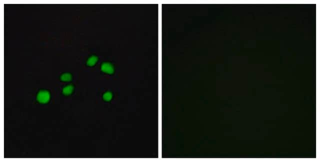 Anti-Collagen XXIII &#945;1 antibody produced in rabbit affinity isolated antibody