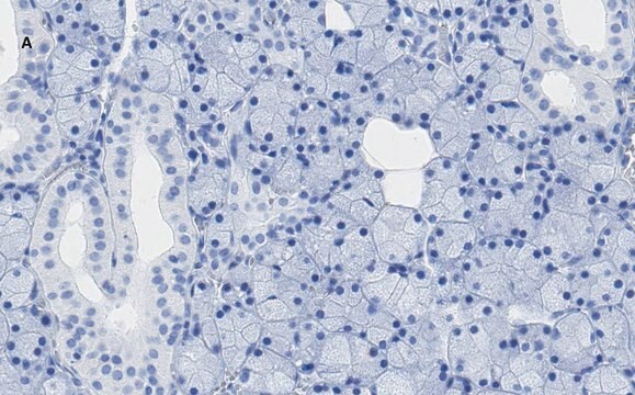 Anti-TMEM16A Antibody, clone 3J18, ZooMAb&#174; Rabbit Monoclonal recombinant, expressed in HEK 293 cells