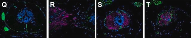 Anti-laminina antibody produced in rabbit 0.5&#160;mg/mL, affinity isolated antibody, buffered aqueous solution