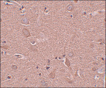 Anti-SRPX1 antibody produced in rabbit affinity isolated antibody, buffered aqueous solution