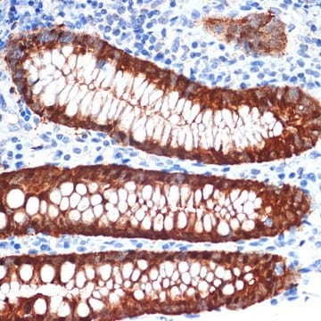 Anti-Galectin 4/LGALS4 antibody produced in rabbit