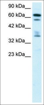 Anti-ZNF512 antibody produced in rabbit affinity isolated antibody