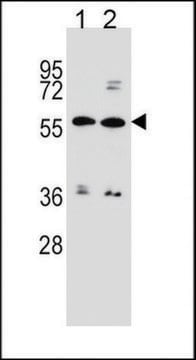 ANTI-ABCG4 (N-TERM) antibody produced in rabbit IgG fraction of antiserum, buffered aqueous solution