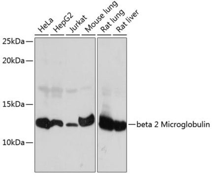 Anti-beta 2 Microglobulin Antibody, clone 5F0O7, Rabbit Monoclonal