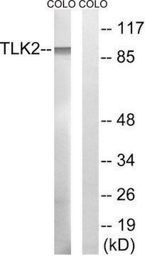 Anti-TLK2 antibody produced in rabbit affinity isolated antibody