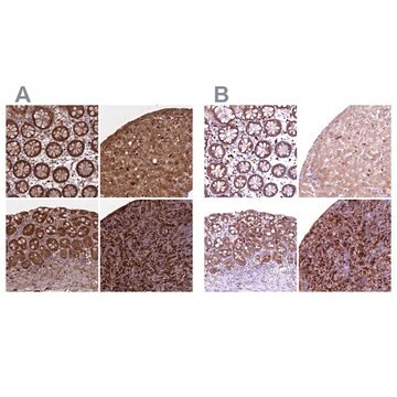 Anti-BLVRB antibody produced in rabbit Prestige Antibodies&#174; Powered by Atlas Antibodies, affinity isolated antibody, buffered aqueous glycerol solution