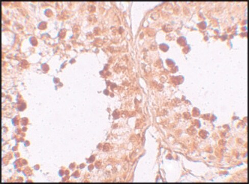 Anti-CRISP2 antibody produced in rabbit affinity isolated antibody, buffered aqueous solution