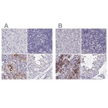 Anti-IGSF1 antibody produced in rabbit Prestige Antibodies&#174; Powered by Atlas Antibodies, affinity isolated antibody, buffered aqueous glycerol solution