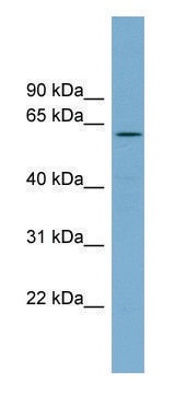 Anti-RIOK2 antibody produced in rabbit affinity isolated antibody