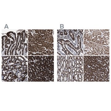 Anti-ECHS1 antibody produced in rabbit Prestige Antibodies&#174; Powered by Atlas Antibodies, affinity isolated antibody, buffered aqueous glycerol solution, Ab2