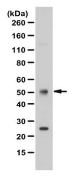 Anti-FOXL2 Antibody from rabbit, purified by affinity chromatography