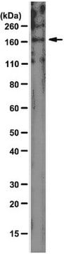 Anti-UPAR-Associated Protein Antibody, clone 2.h.9:F12 clone 2.h.9:F12, from mouse