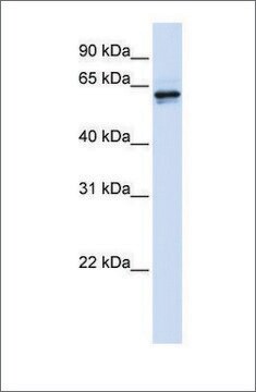 Anti-PHGDH antibody produced in rabbit affinity isolated antibody