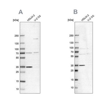 Anti-TTC19 antibody produced in rabbit Prestige Antibodies&#174; Powered by Atlas Antibodies, affinity isolated antibody, buffered aqueous glycerol solution