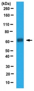 Anticuerpo anti-DMT1 serum, from rabbit