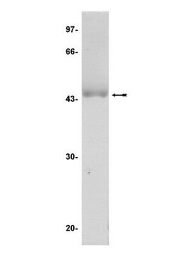 JNK1&#945;1/SAPK1c Protein, active, 10 &#181;g Active, recombinant full-length human JNK1&#945;1/SAPK1c with an N-terminal His-tag, for use in Kinase Assays.