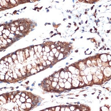 Anti-STK39 antibody produced in rabbit