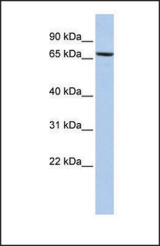 Anti-PDIA4 antibody produced in rabbit affinity isolated antibody