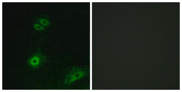 Anti-OR4A16 antibody produced in rabbit affinity isolated antibody