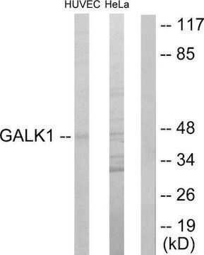 Anti-GALK1 antibody produced in rabbit affinity isolated antibody