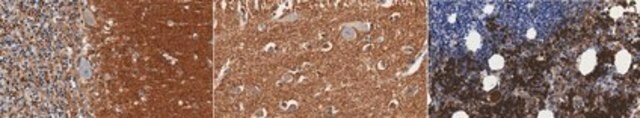 Anti-alpha-Synuclein Antibody, clone 9C4 clone 9C4, from mouse