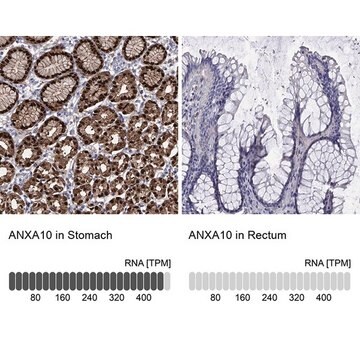 Anti-ANXA10 antibody produced in rabbit Prestige Antibodies&#174; Powered by Atlas Antibodies, affinity isolated antibody, buffered aqueous glycerol solution