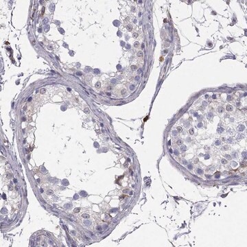 Anti-ENOX1 antibody produced in rabbit Prestige Antibodies&#174; Powered by Atlas Antibodies, affinity isolated antibody, buffered aqueous glycerol solution