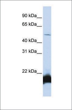 Anti-ONECUT1 (ab1) antibody produced in rabbit affinity isolated antibody