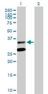 Anti-ASPA antibody produced in mouse purified immunoglobulin, buffered aqueous solution