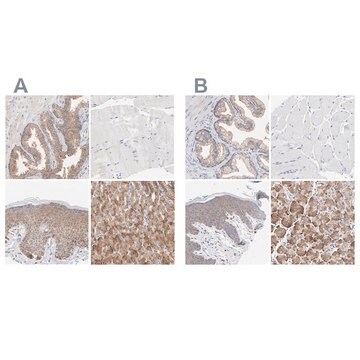 Anti-PPFIBP2 antibody produced in rabbit Ab2, Prestige Antibodies&#174; Powered by Atlas Antibodies, affinity isolated antibody, buffered aqueous glycerol solution