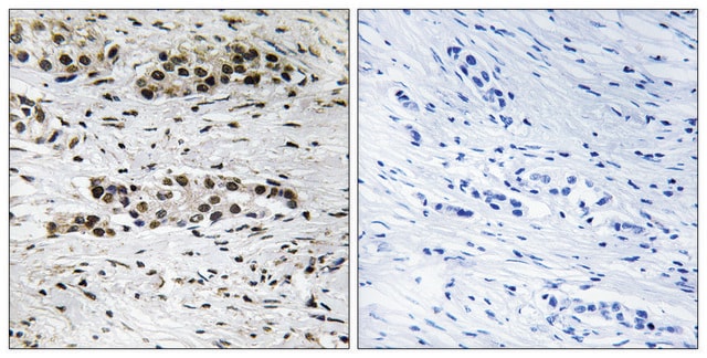 Anti-phospho-Estrogen Receptor-&#945; (pSer102) antibody produced in rabbit affinity isolated antibody