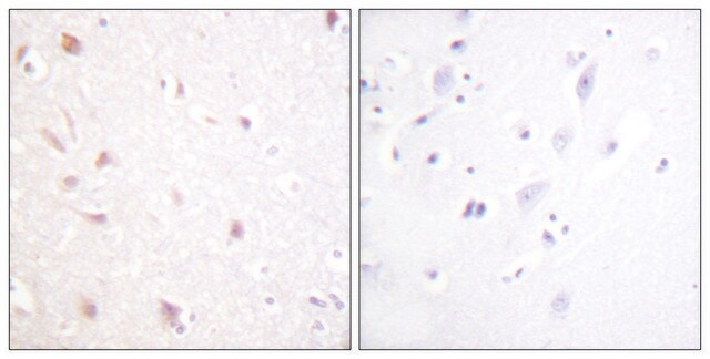 Anti-NIFK antibody produced in rabbit affinity isolated antibody