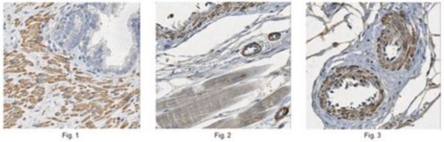 Anti-Tropomyosin 4 Antibody from rabbit, purified by affinity chromatography