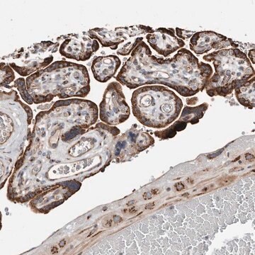 Anti-COG1 antibody produced in rabbit Prestige Antibodies&#174; Powered by Atlas Antibodies, affinity isolated antibody, buffered aqueous glycerol solution