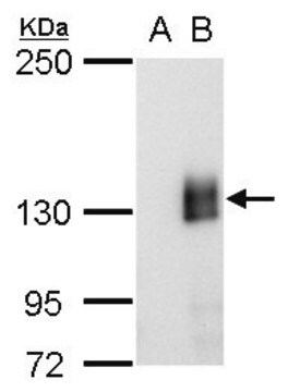 抗mCherry单抗 小鼠抗 clone GT857, affinity isolated antibody