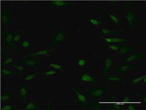 Monoclonal Anti-LYPLA1 antibody produced in mouse clone 3D5, purified immunoglobulin, buffered aqueous solution