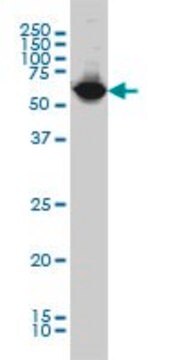 Monoclonal Anti-NARS antibody produced in mouse clone 2D6, purified immunoglobulin, buffered aqueous solution