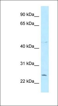 Anti-CCDC85B antibody produced in rabbit affinity isolated antibody